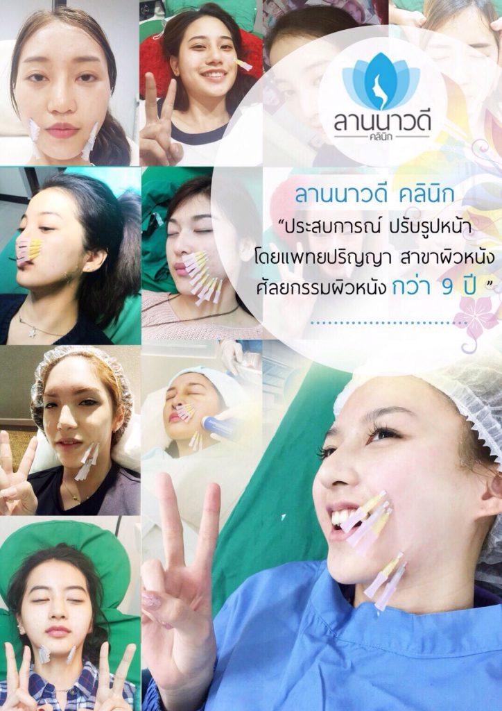 ศัลยกรรมตกแต่ง ลานนาวดีคลินิก