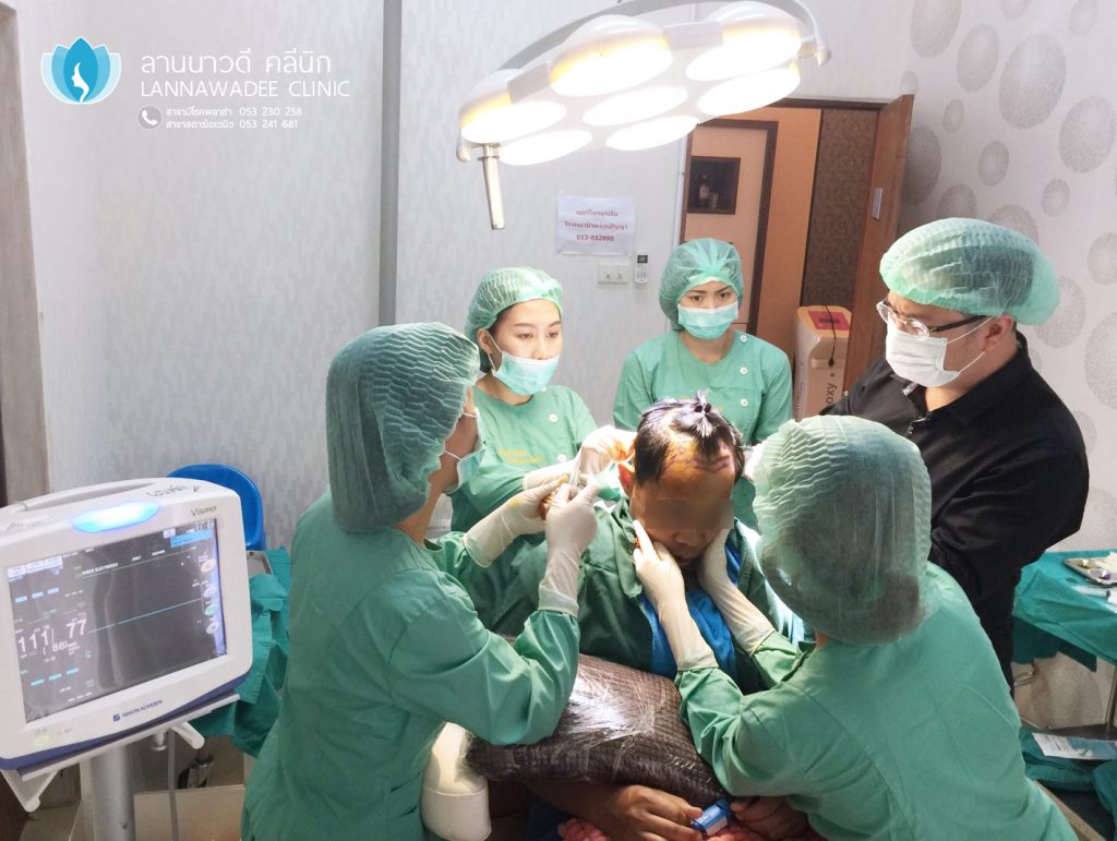 รีวิวปลูกผมเชียงใหม่