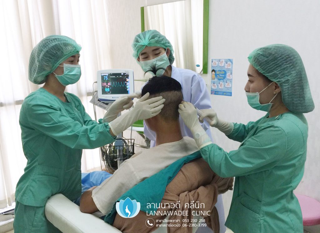 รีวิวปลูกผมเชียงใหม่