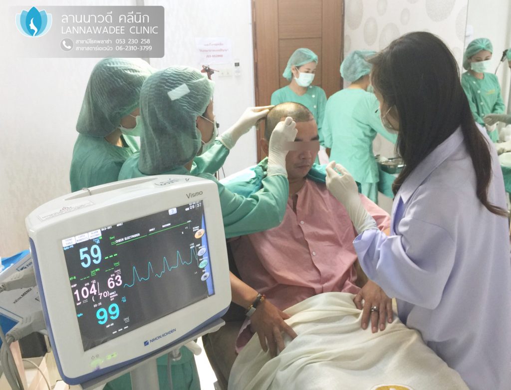 รีวิวปลูกผมเชียงใหม่