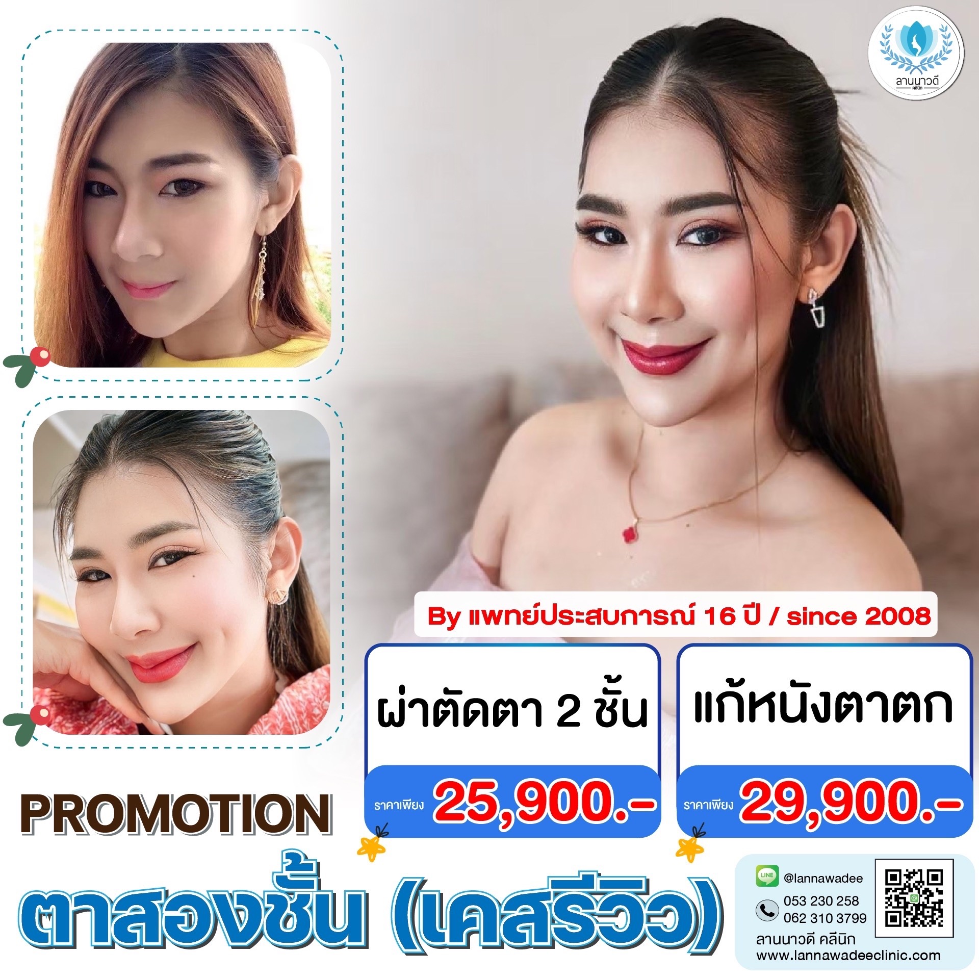 คิดไม่ตก เรื่องหนังตา