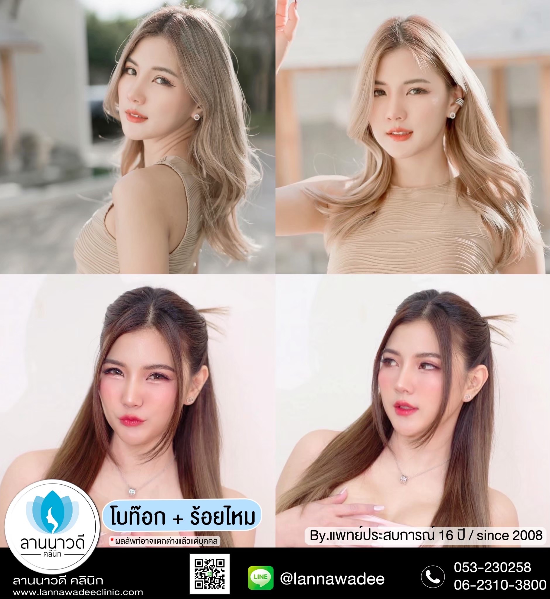 ฟิลเลอร์