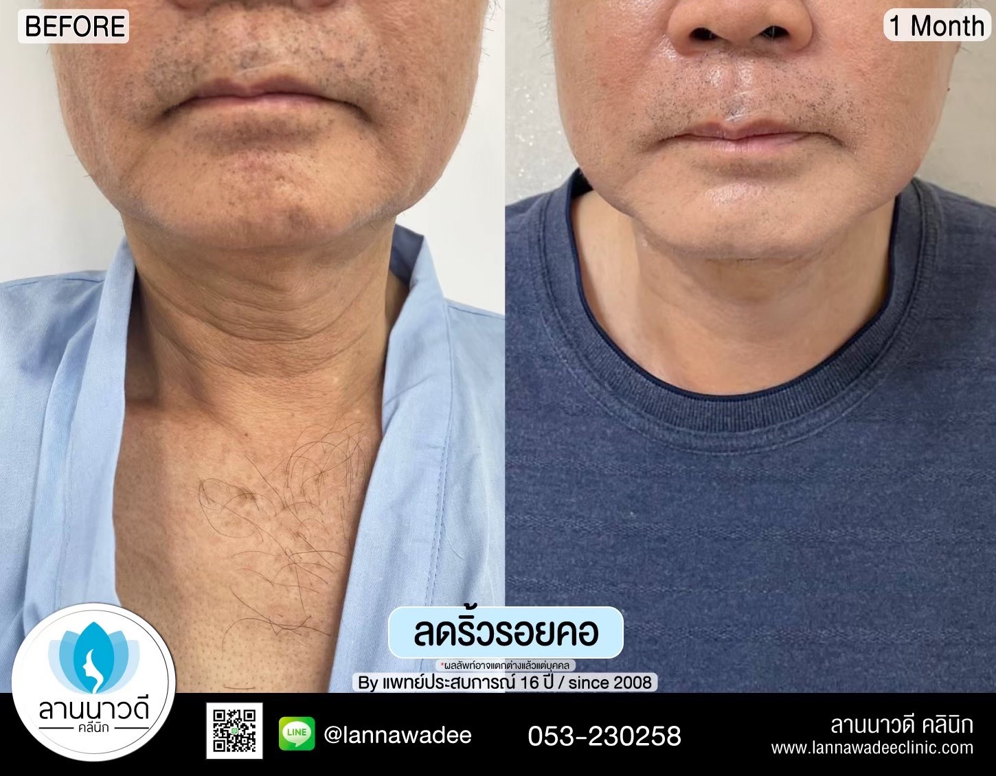 กระชับ