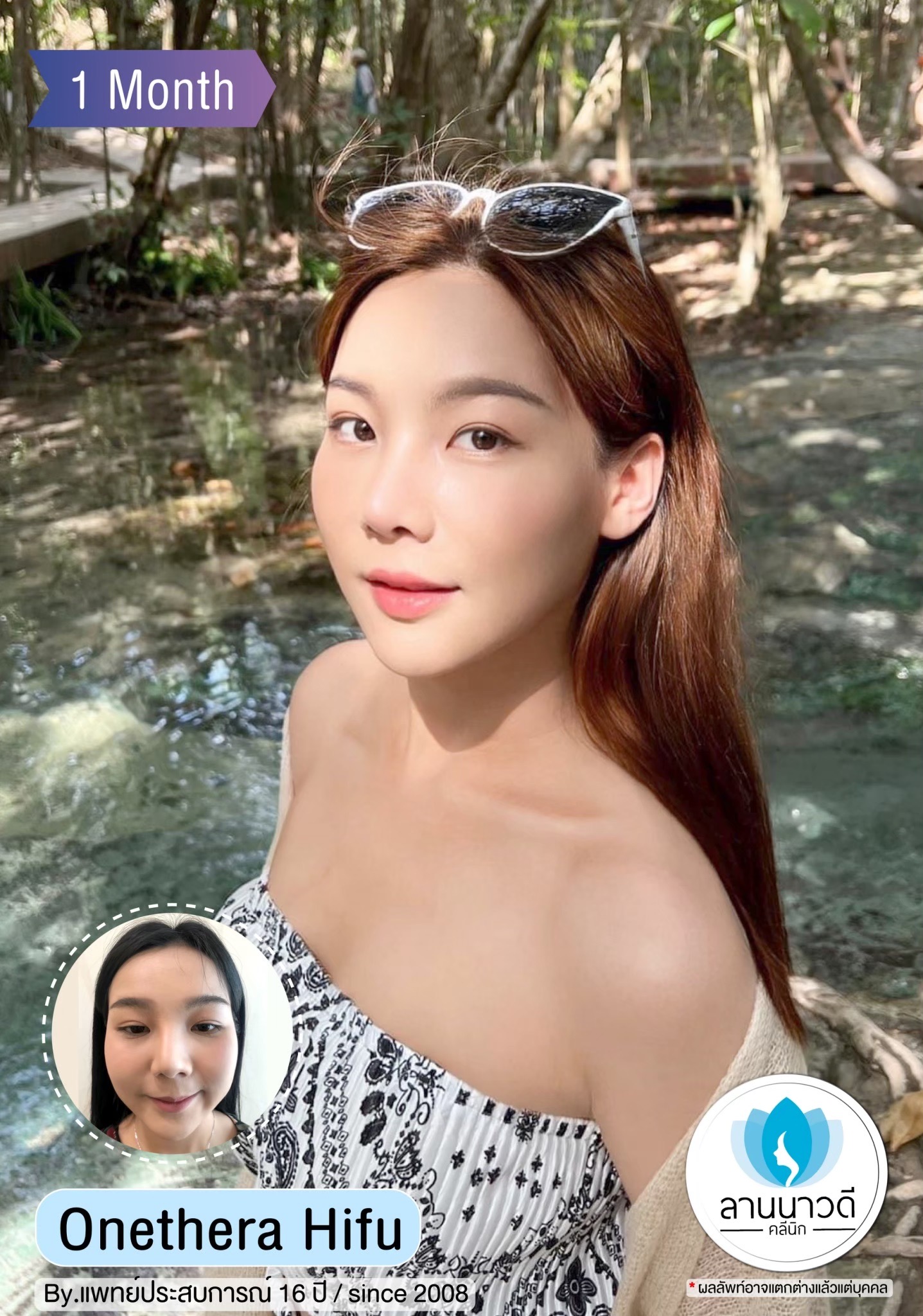 กระชับ