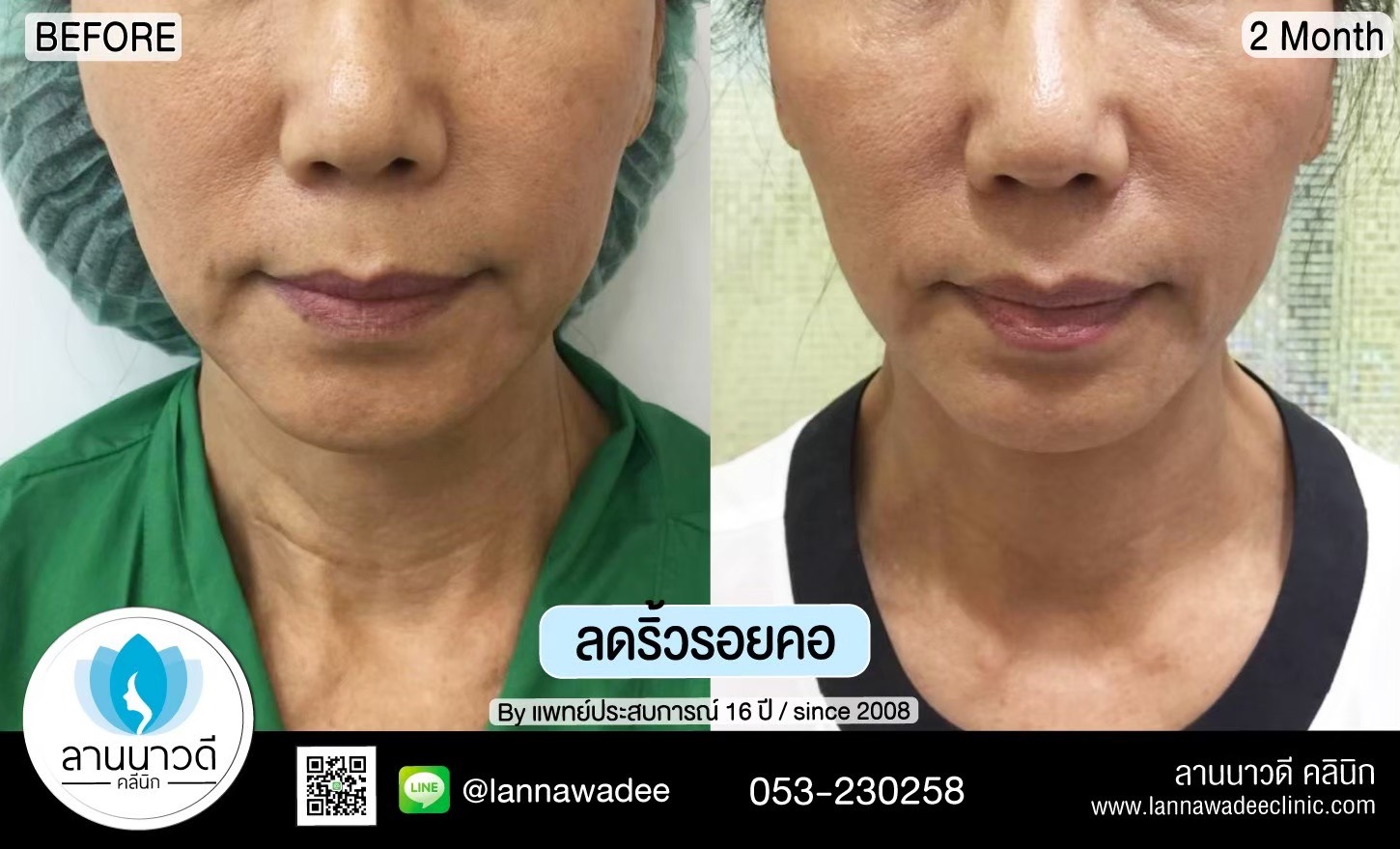 กระชับ