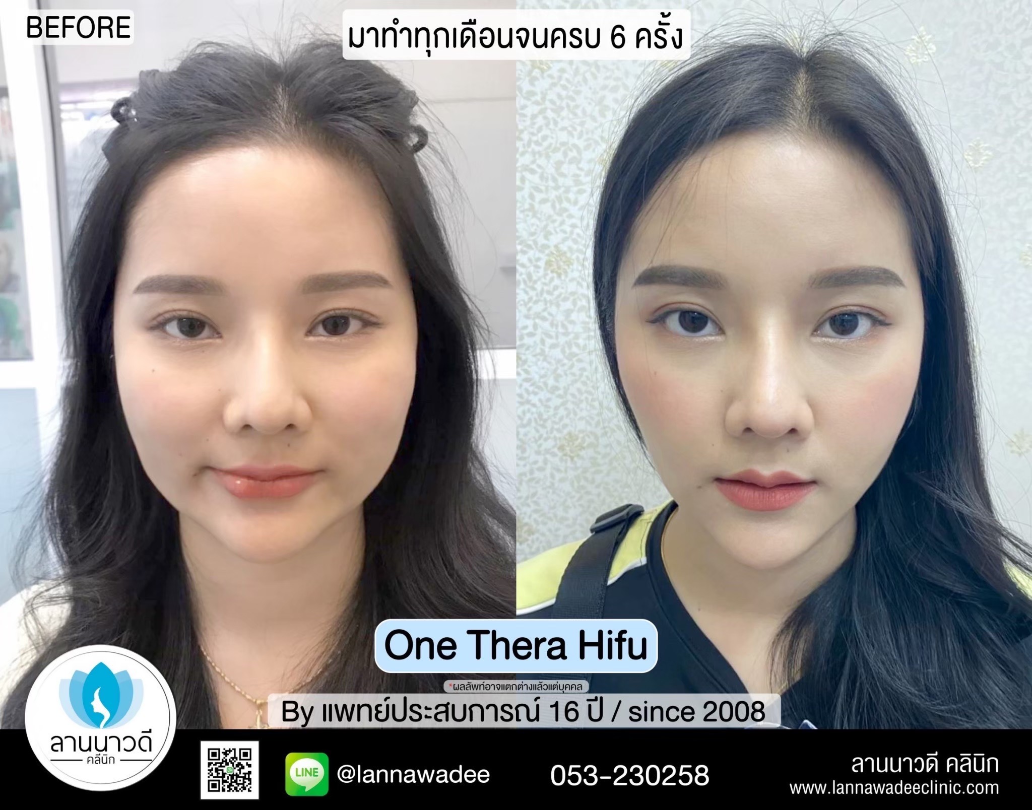 กระชับ