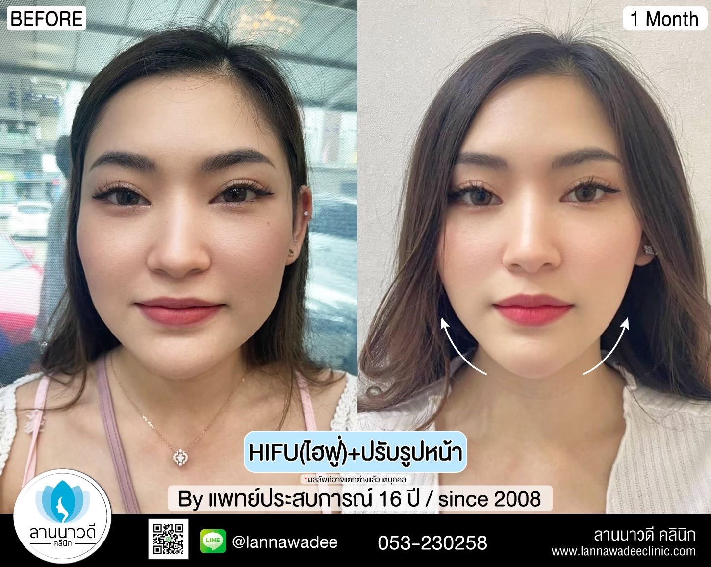 กระชับ