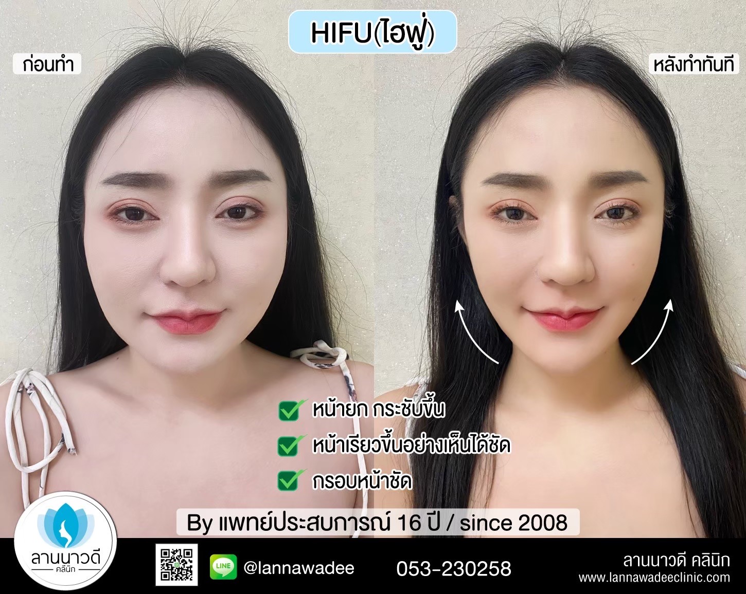 กระชับ