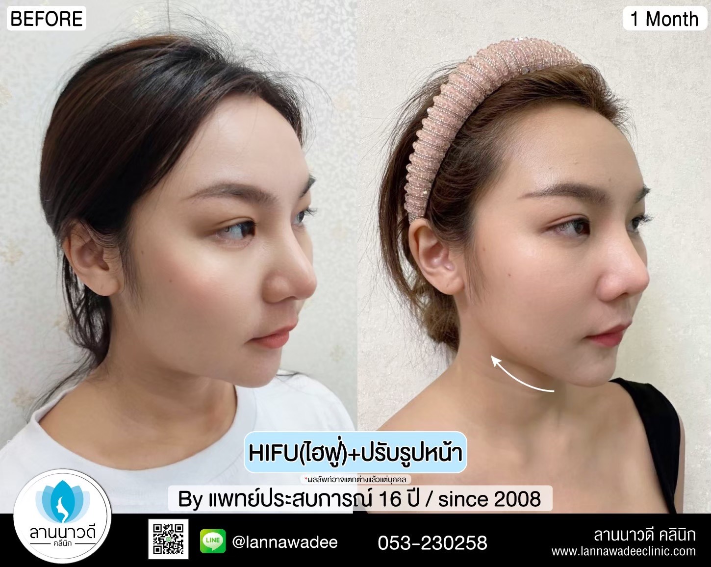 กระชับ