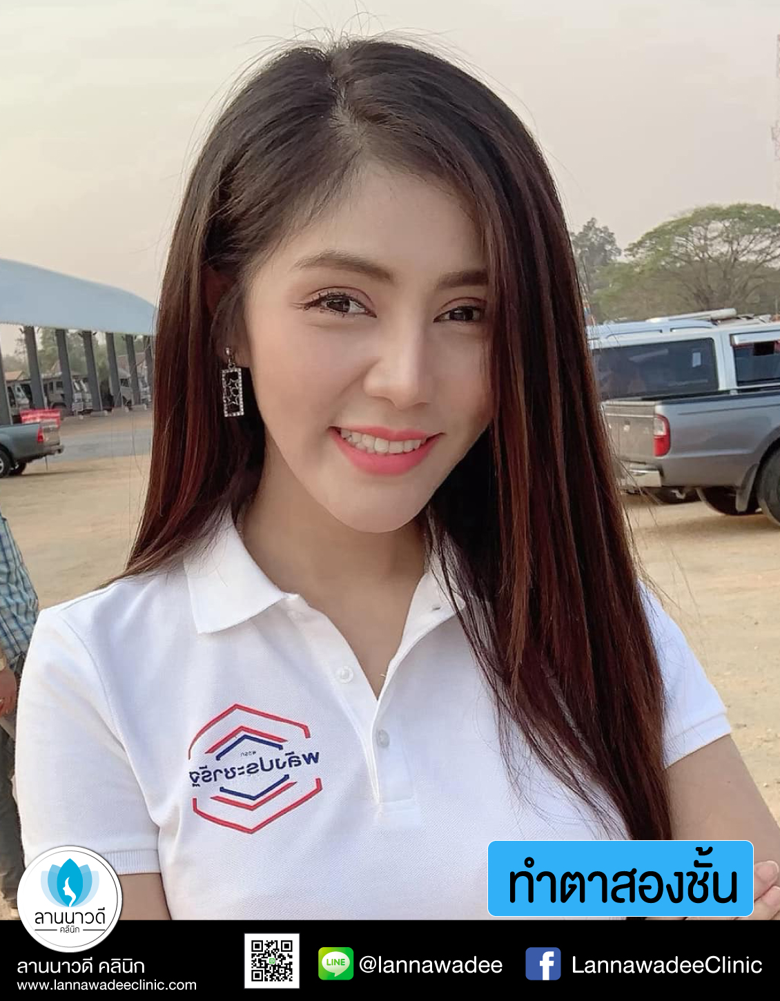 ทำตาสองชั้น รีวิว