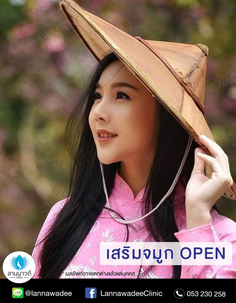 แก้จมูก OPEN