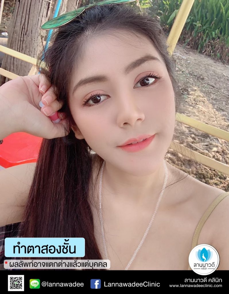 ทำตาสองชั้น รีวิว