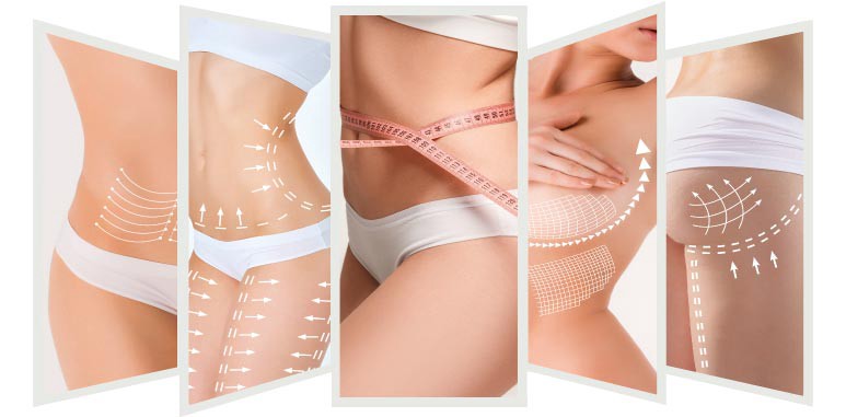 Liposuction Chiang Mai