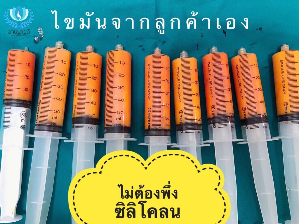 ฉีดไขมันหน้าอก