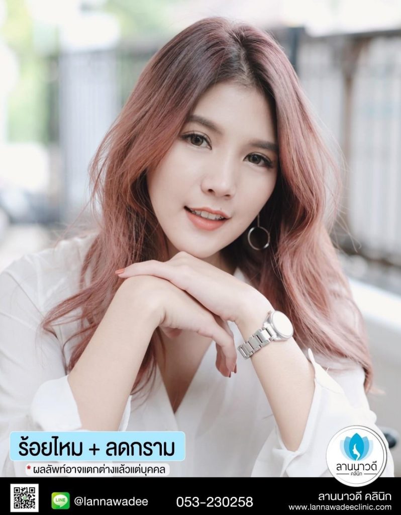 ฉีด Meso Fat เชียงใหม่