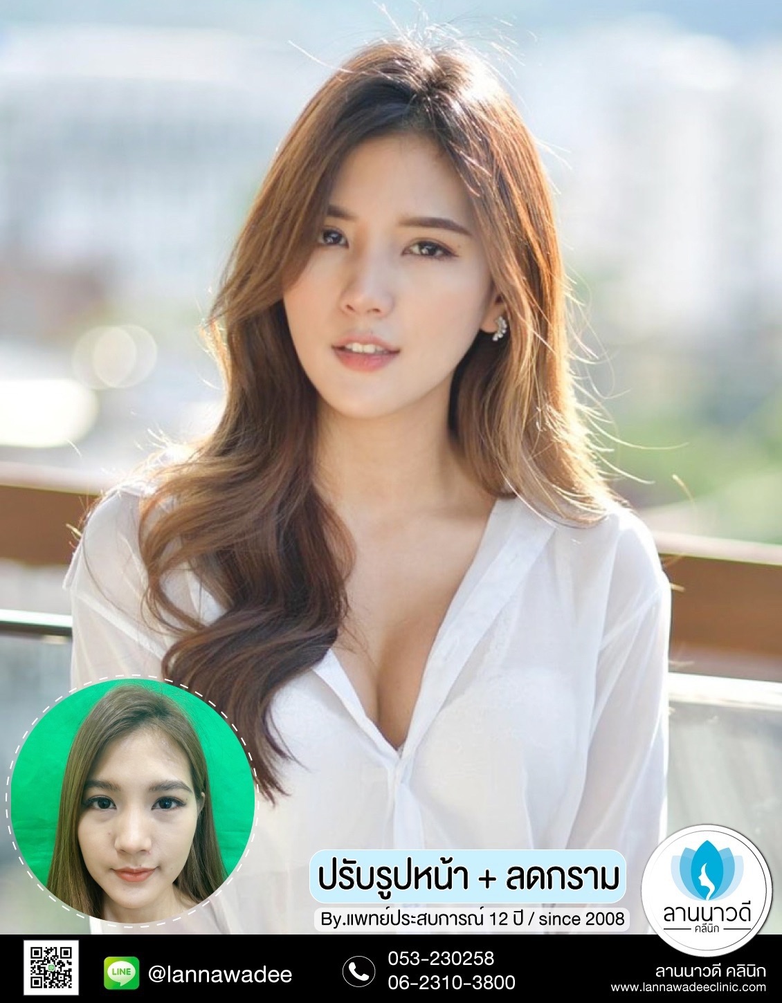 รีวิวฉีดฟิลเลอร์ เชียงใหม่