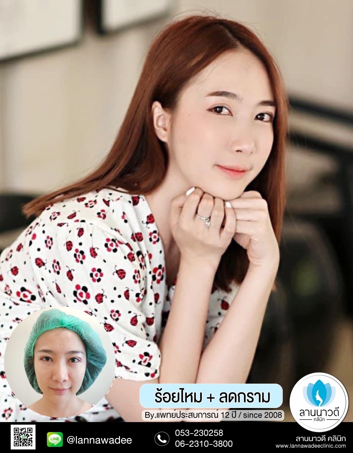 ร้อยไหม เชียงใหม่รีวิว 2566