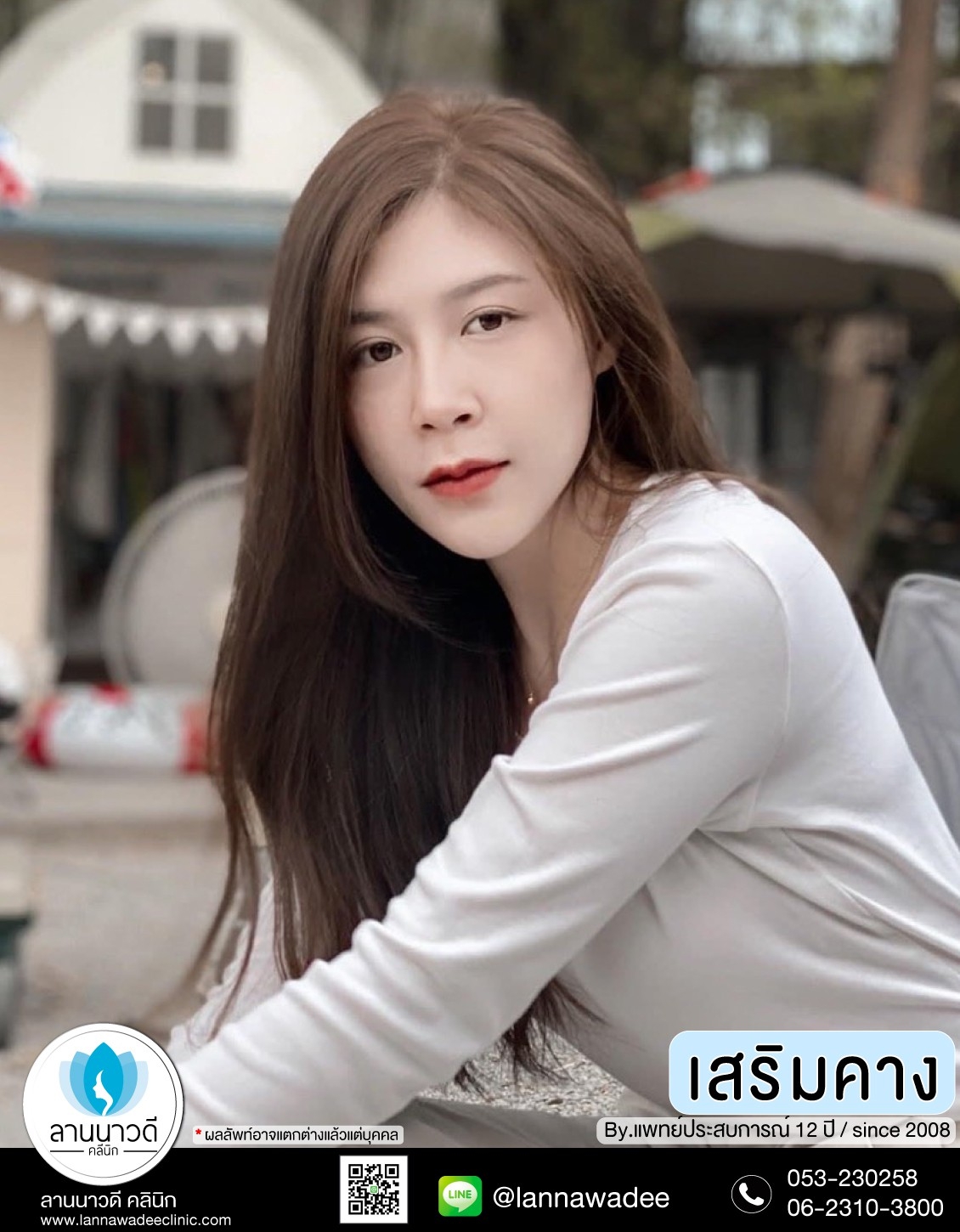 รีวิวเสริมคางเชียงใหม่ 566