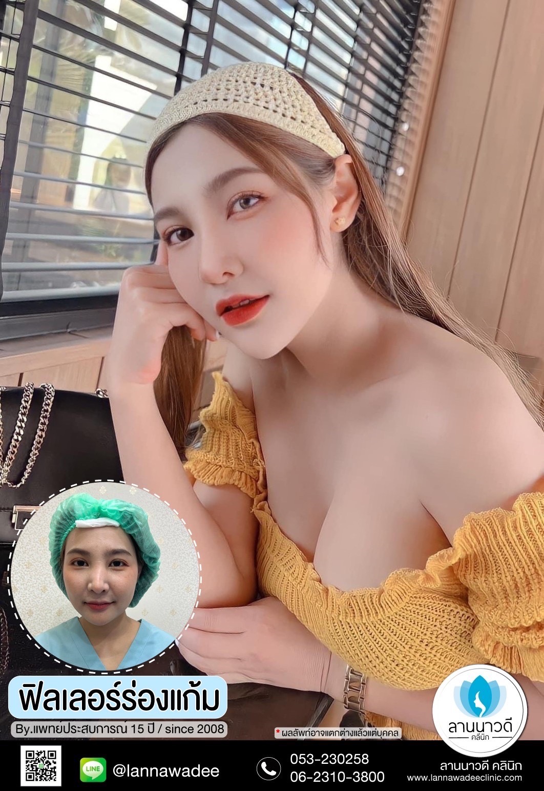 ฉีดฟิลเลอร์ เชียงใหม่