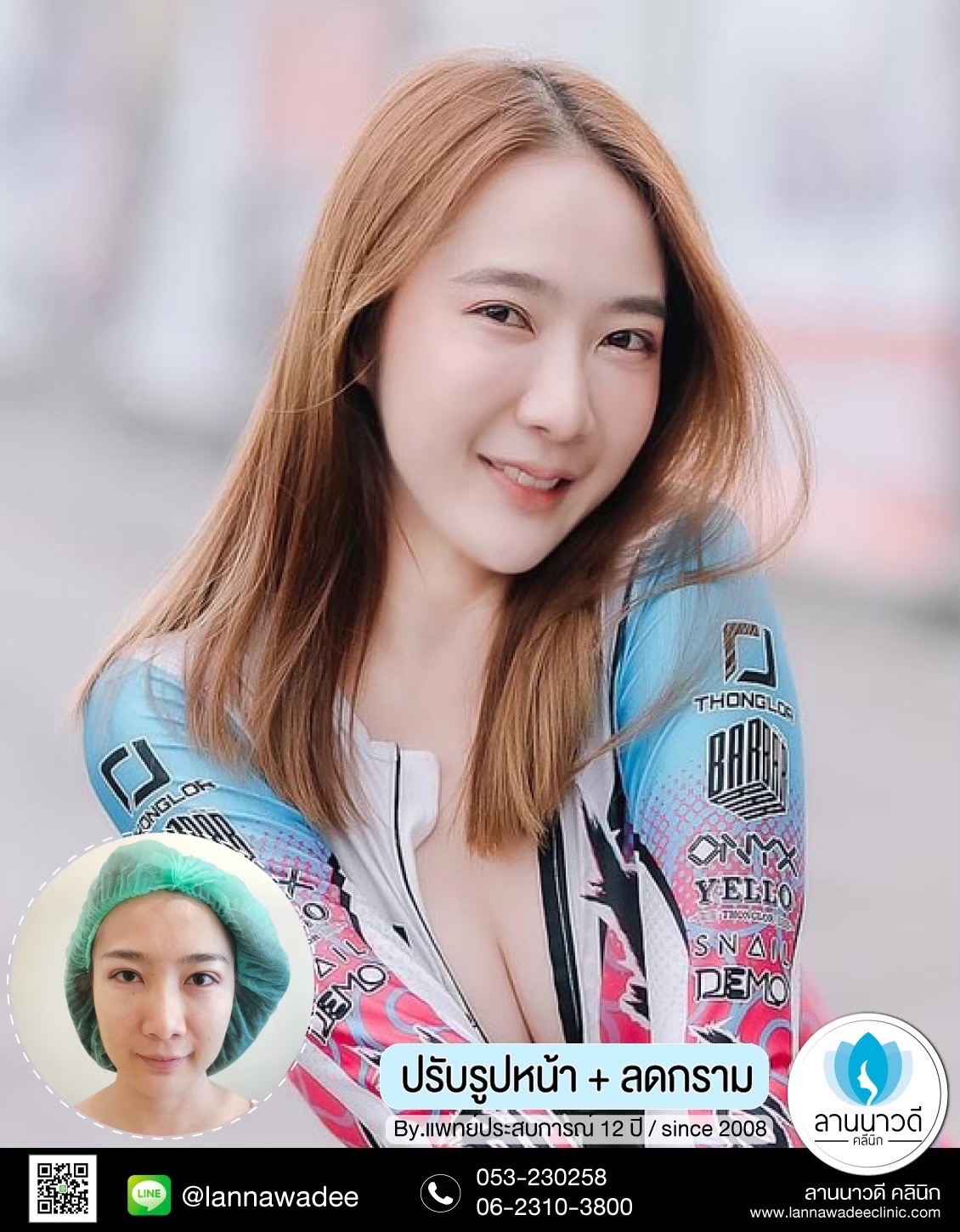 ฉีดโบท็อกซ์ ที่ไหนดี