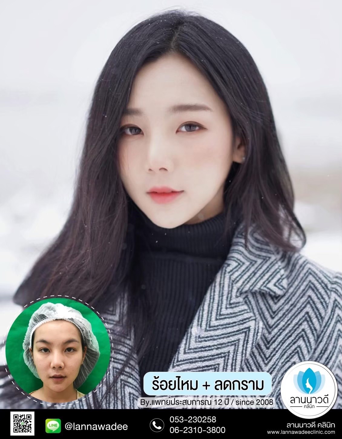 ฉีดโบท็อกซ์ ที่ไหนดี