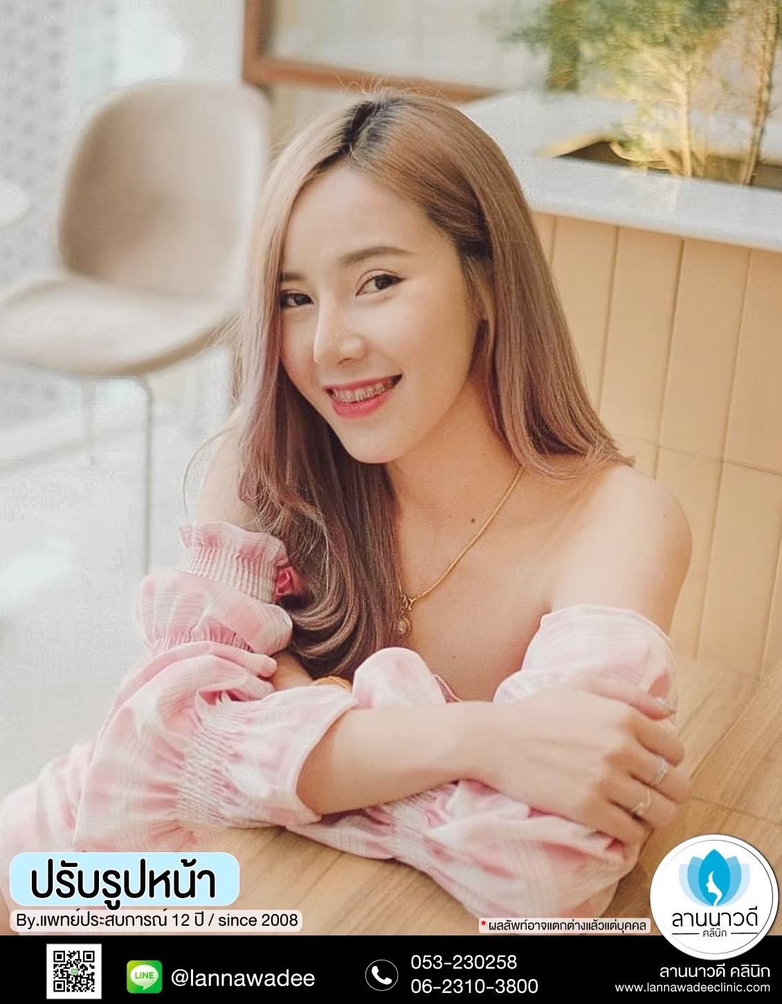 รีวิวปรับรูปหน้าเชียงใหม่