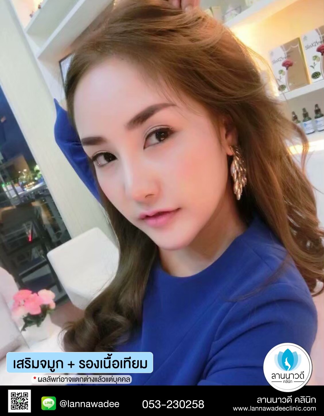 รีวิวเสริมจมูก