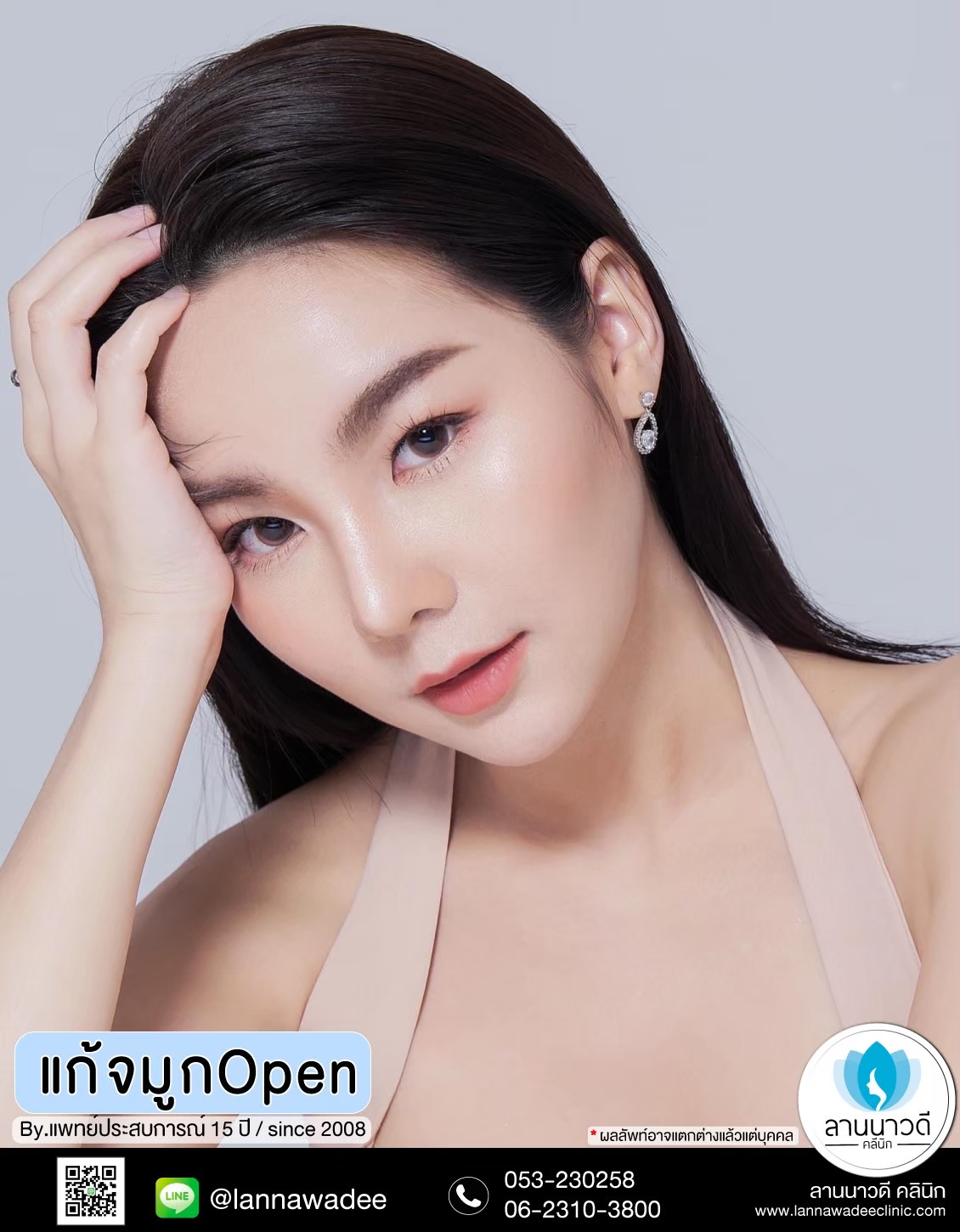 แก้จมูกOPEN