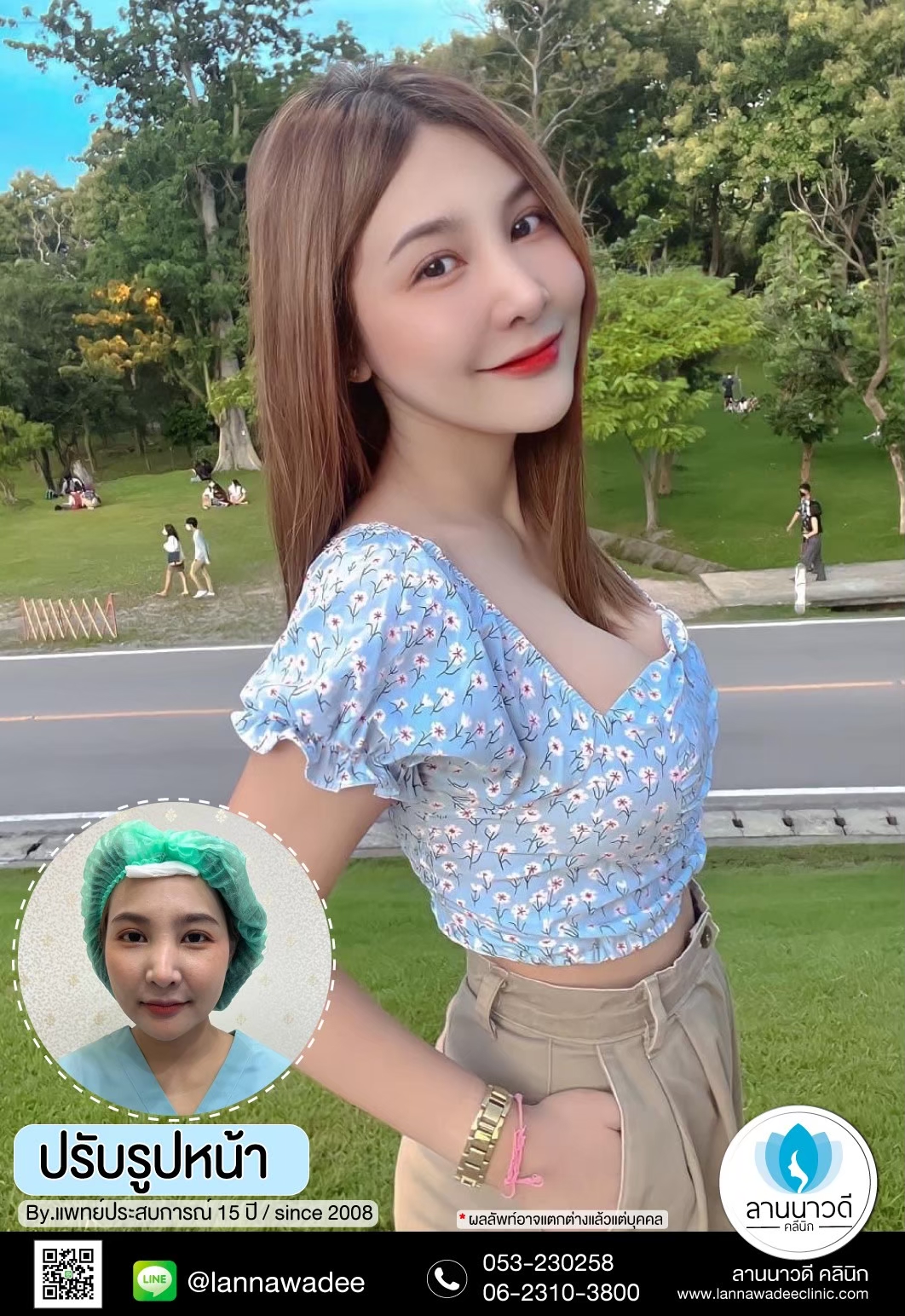 เมโสหน้าใส คืออะไร?