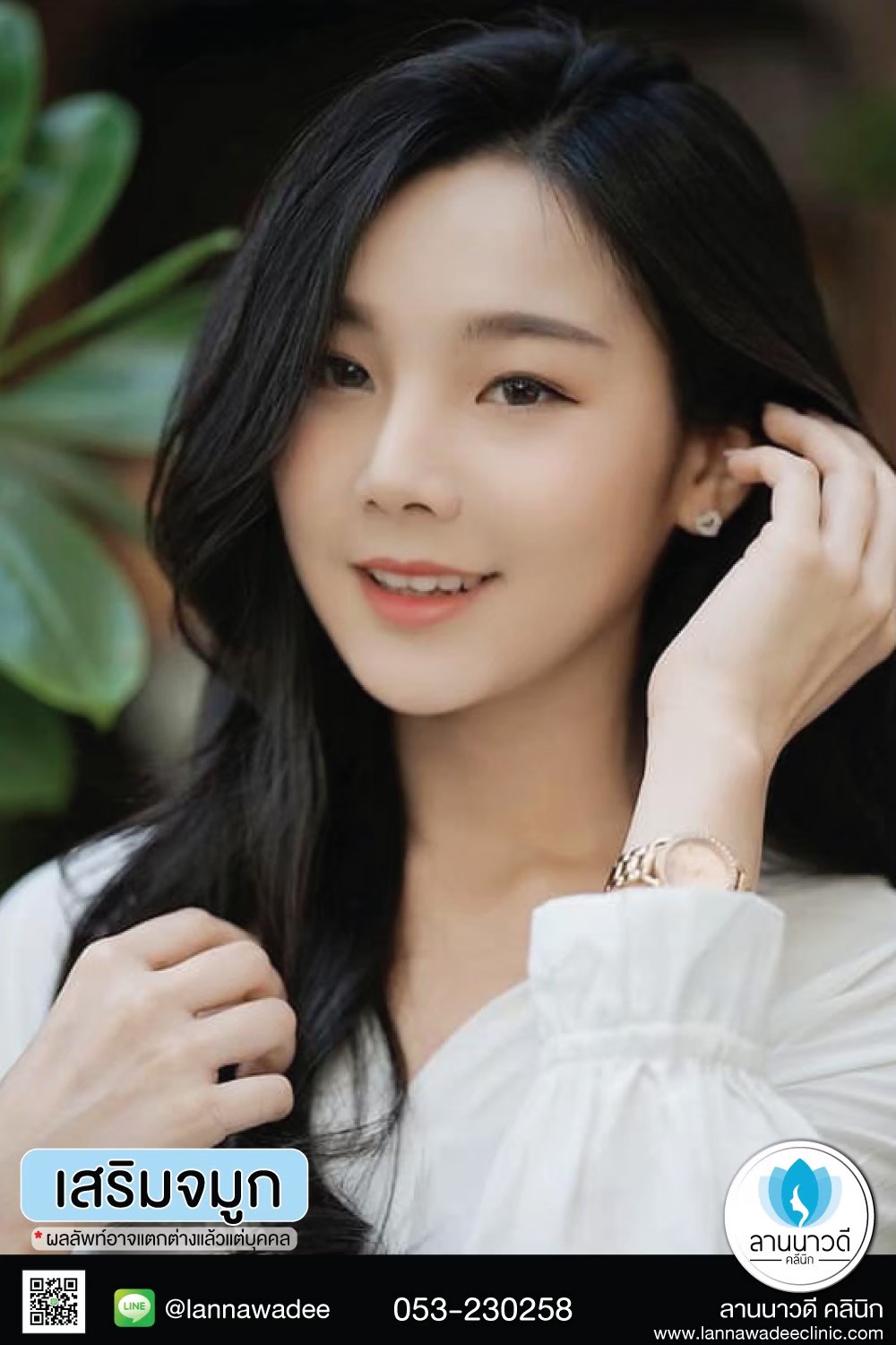 รีวิวเสริมจมูก