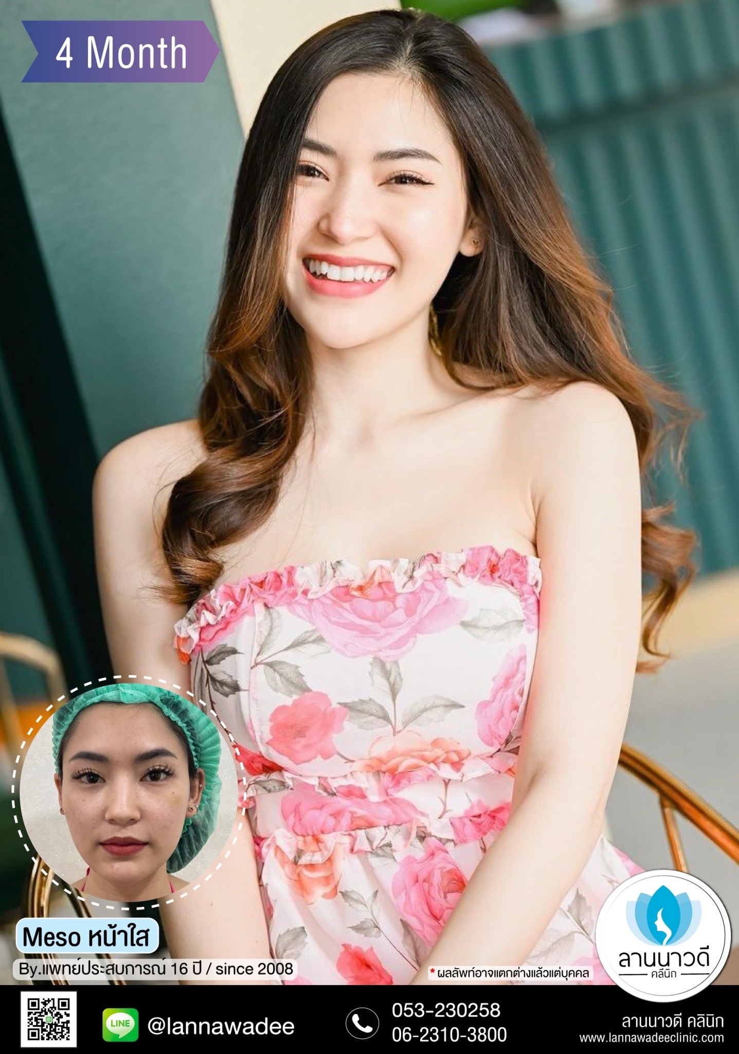 เมโส