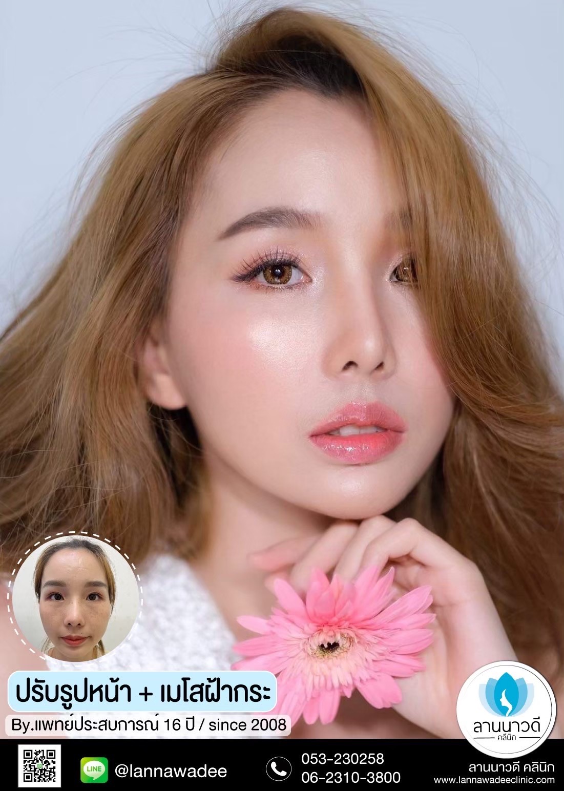 เมโส