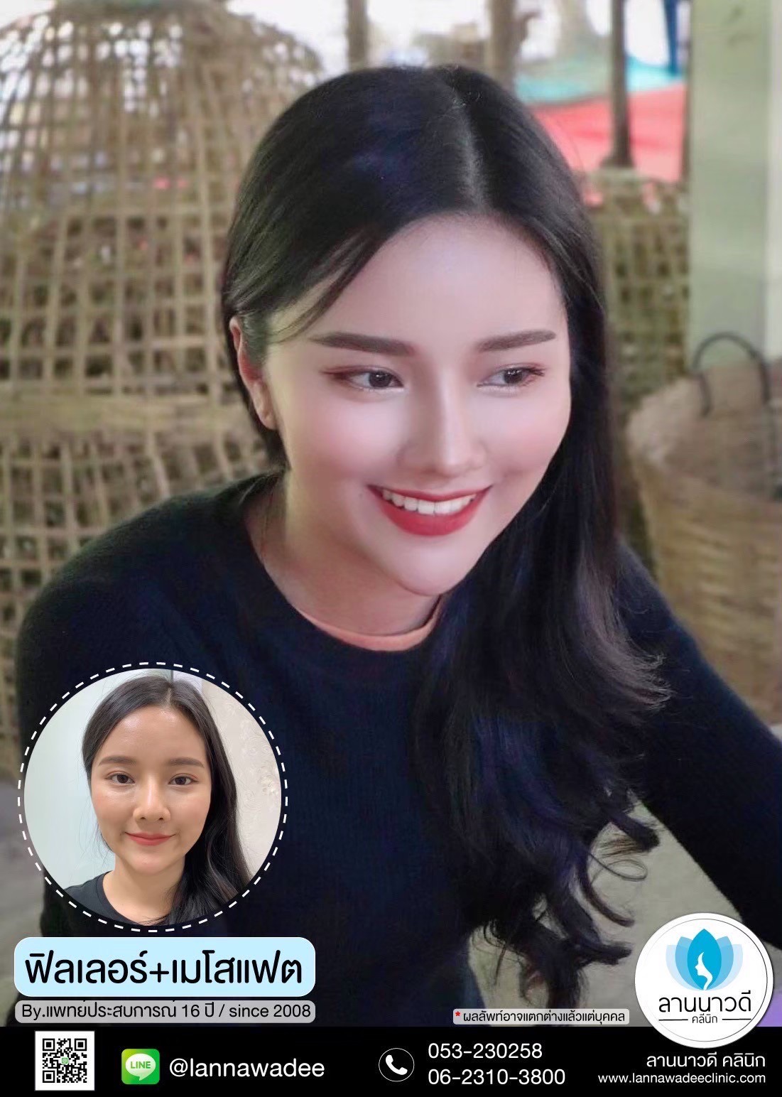 เมโส