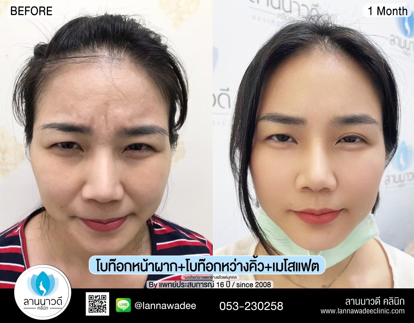 เมโส