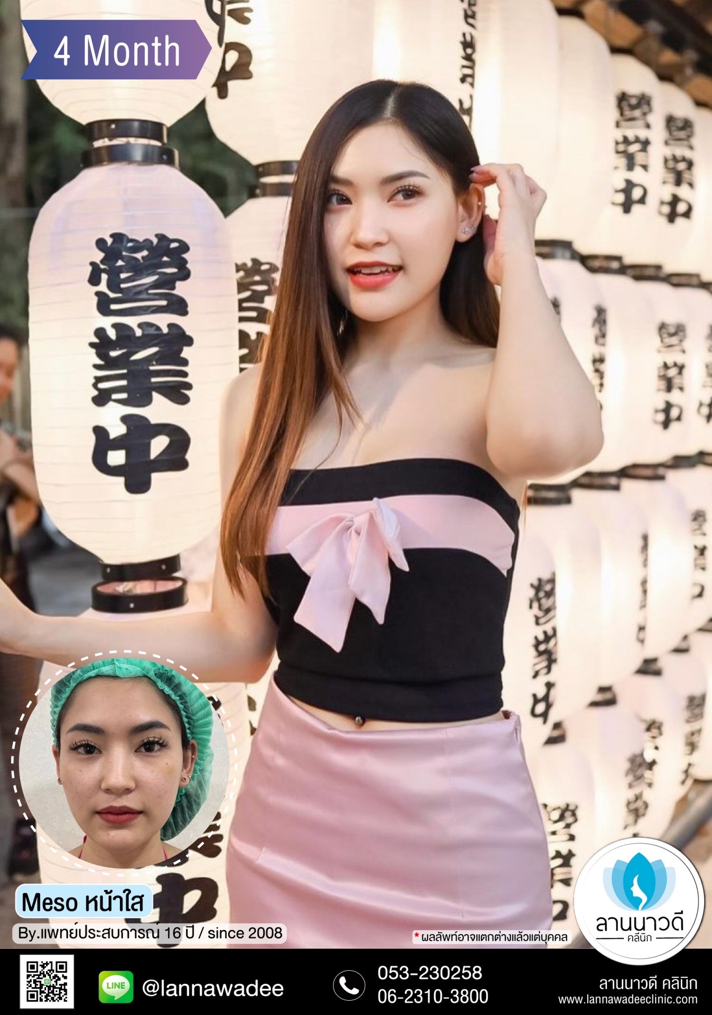 เมโส