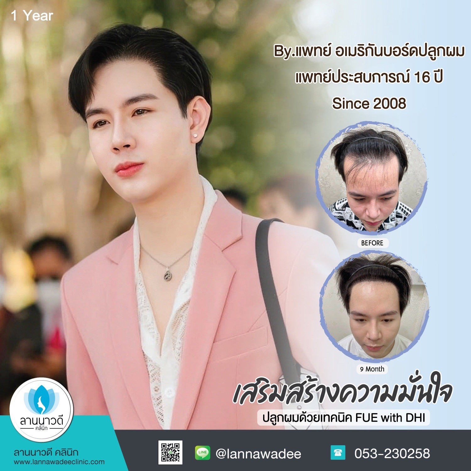 ปลูกผมที่ไหนดี