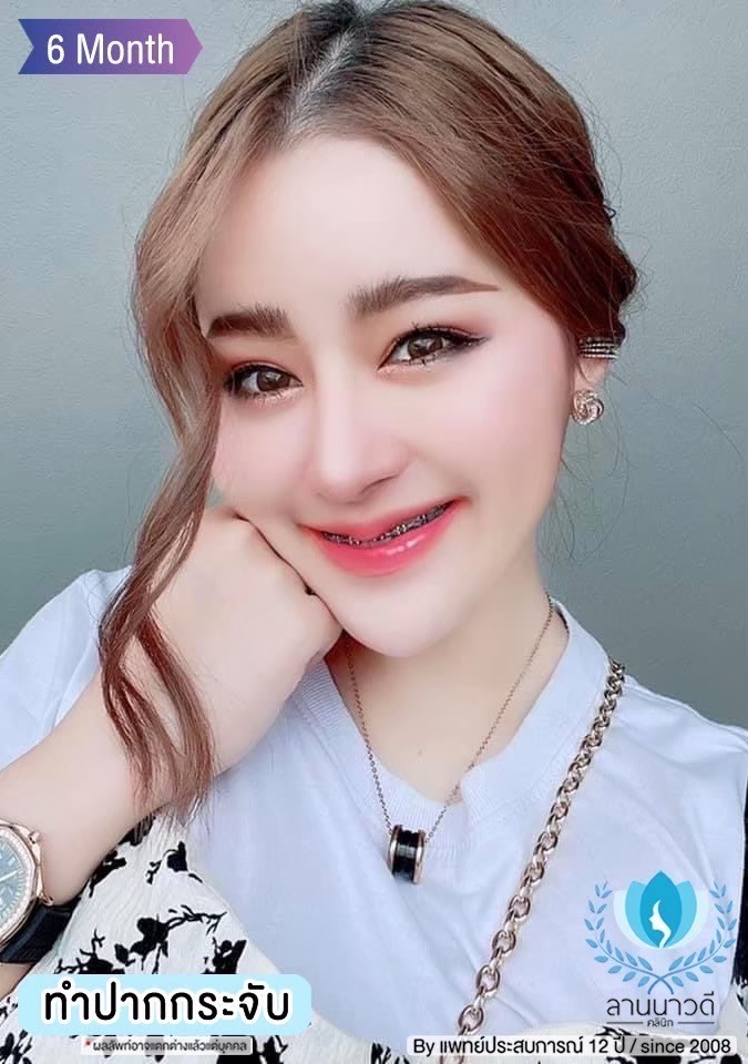 ทำปากกระจับ