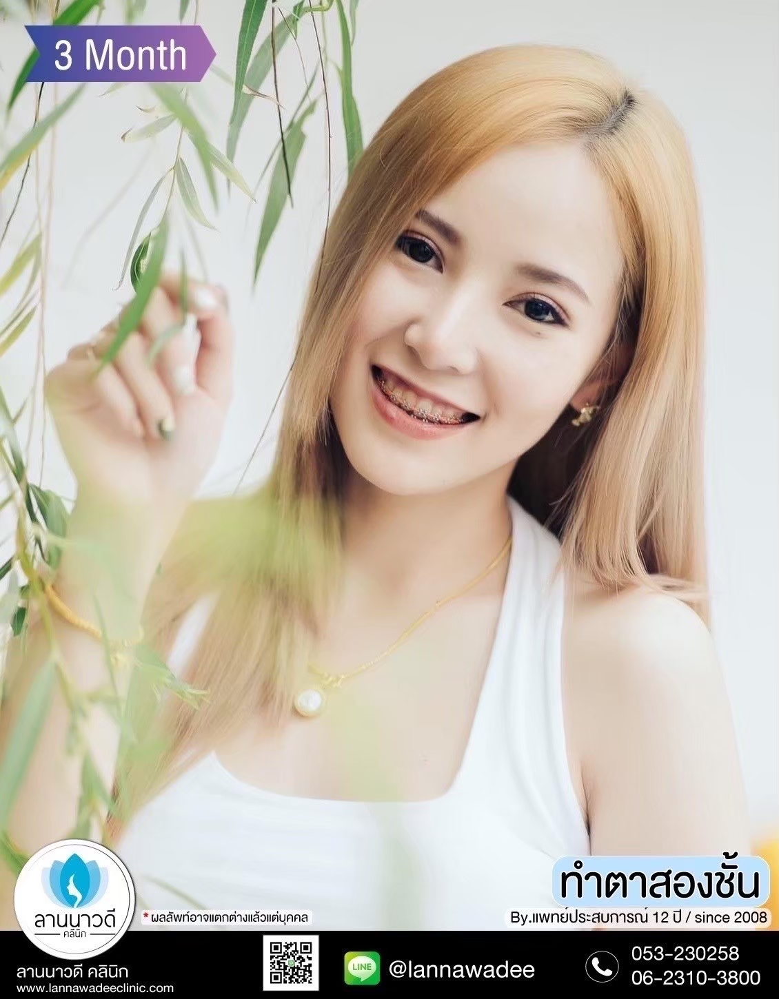 หนังตาตก