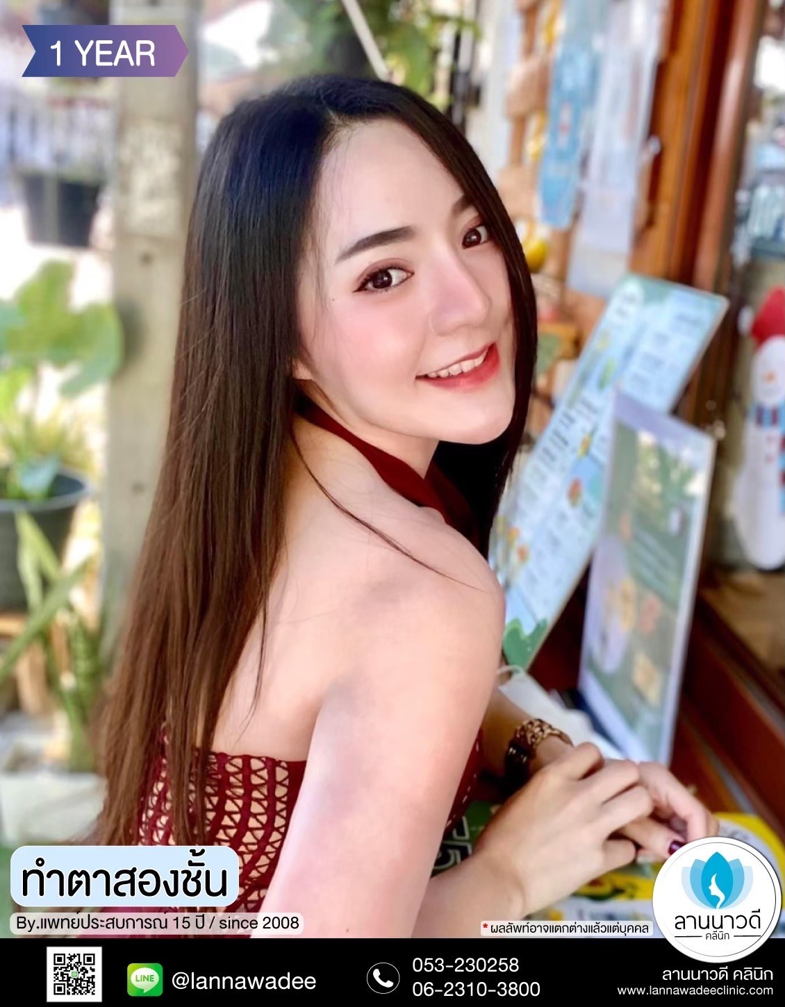 หนังตาตก