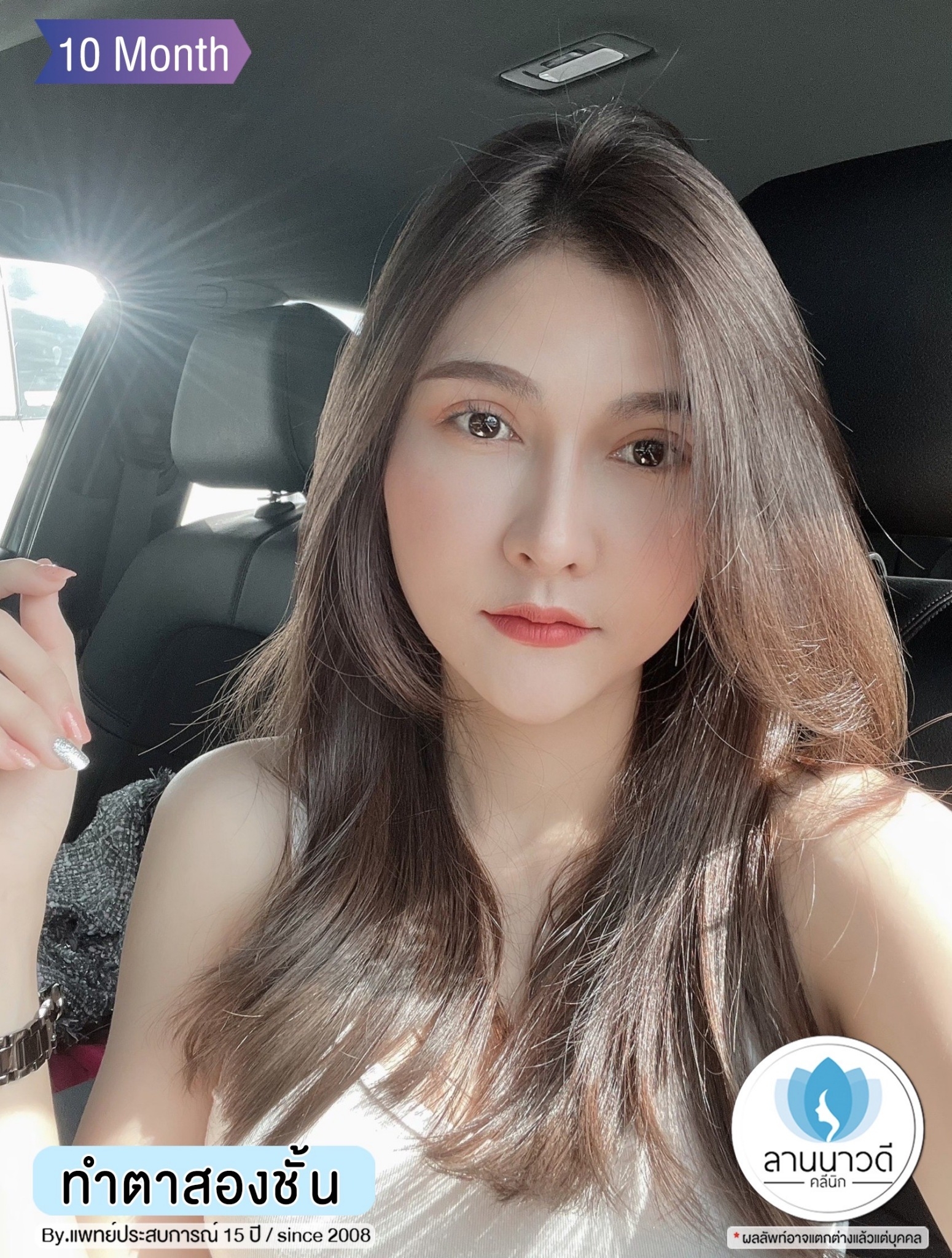 หนังตาตก
