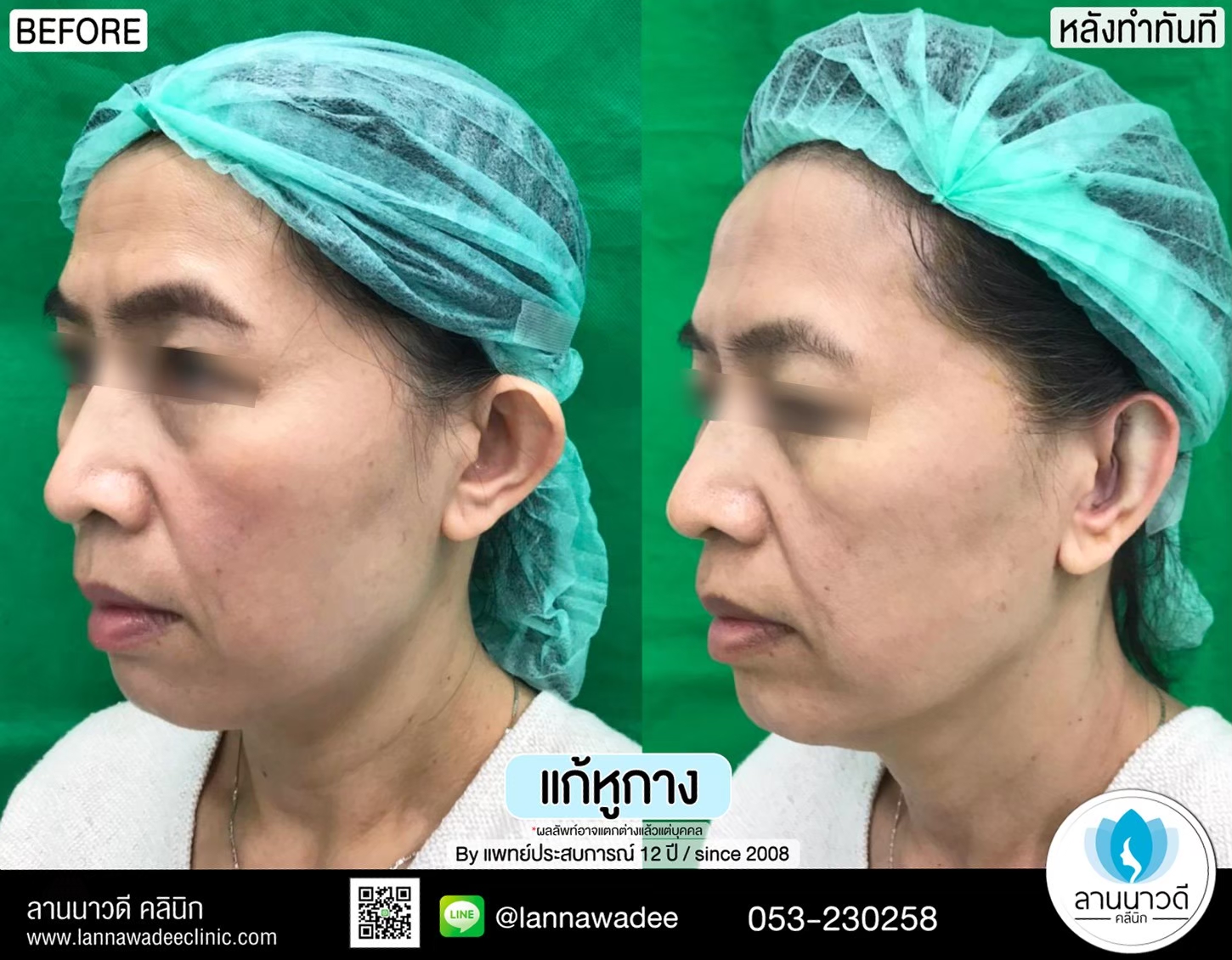รีวิว