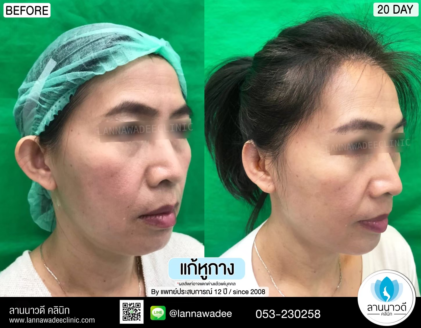 รีวิว