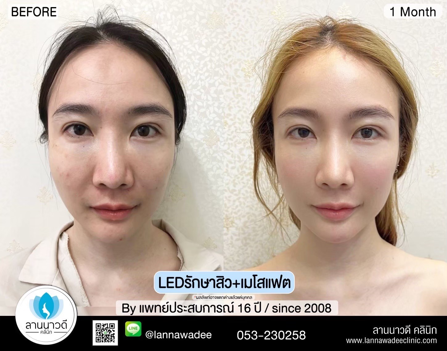 LED