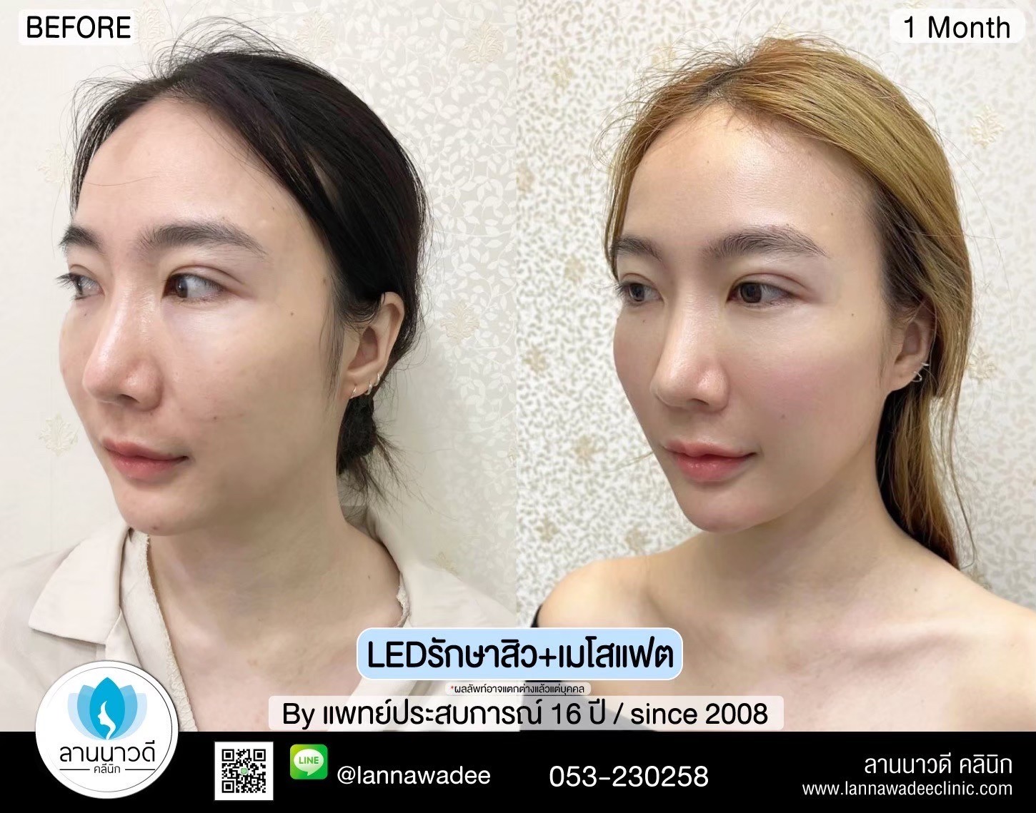 LED