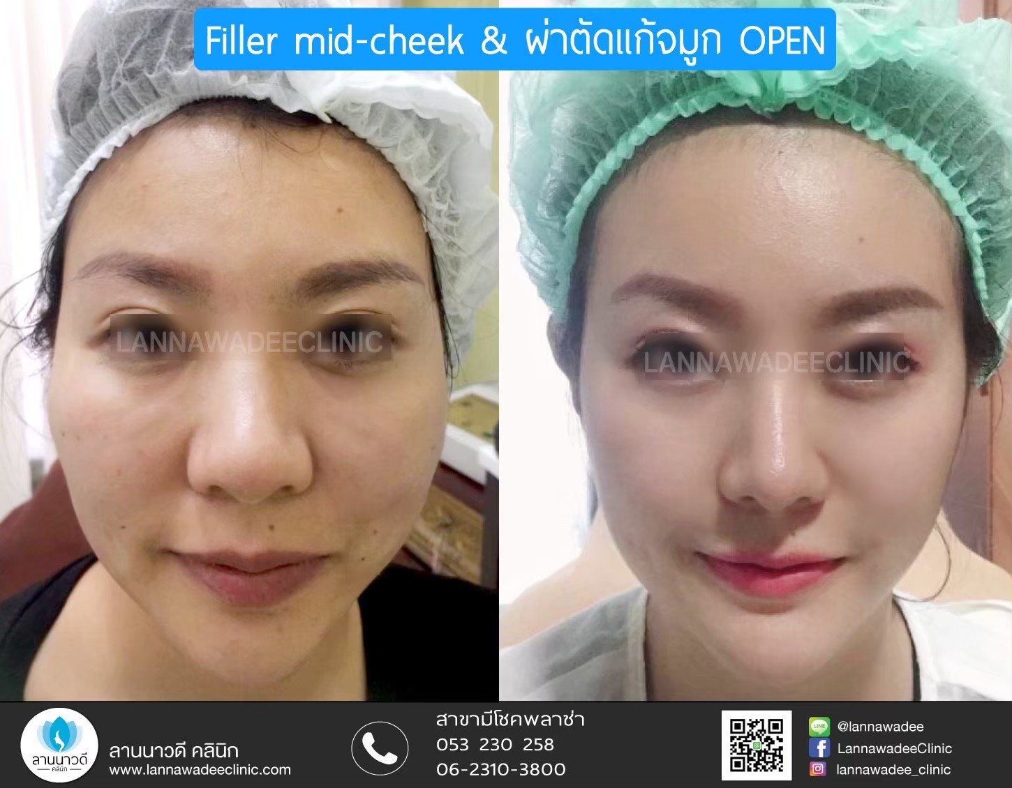 รีวิว