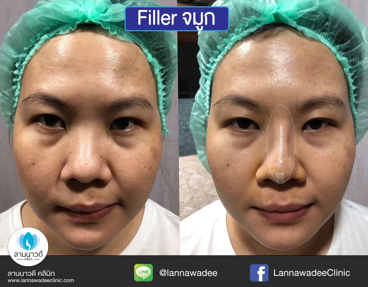 รีวิว