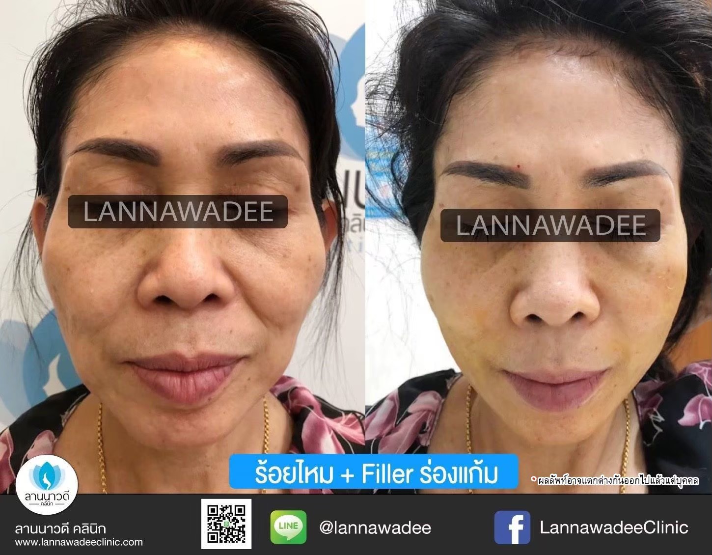รีวิว