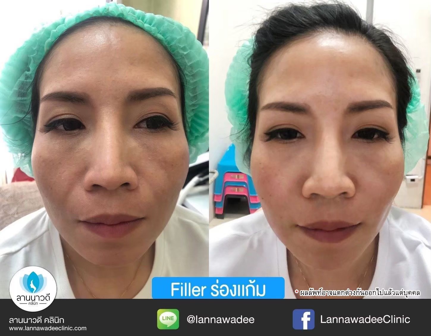 รีวิว
