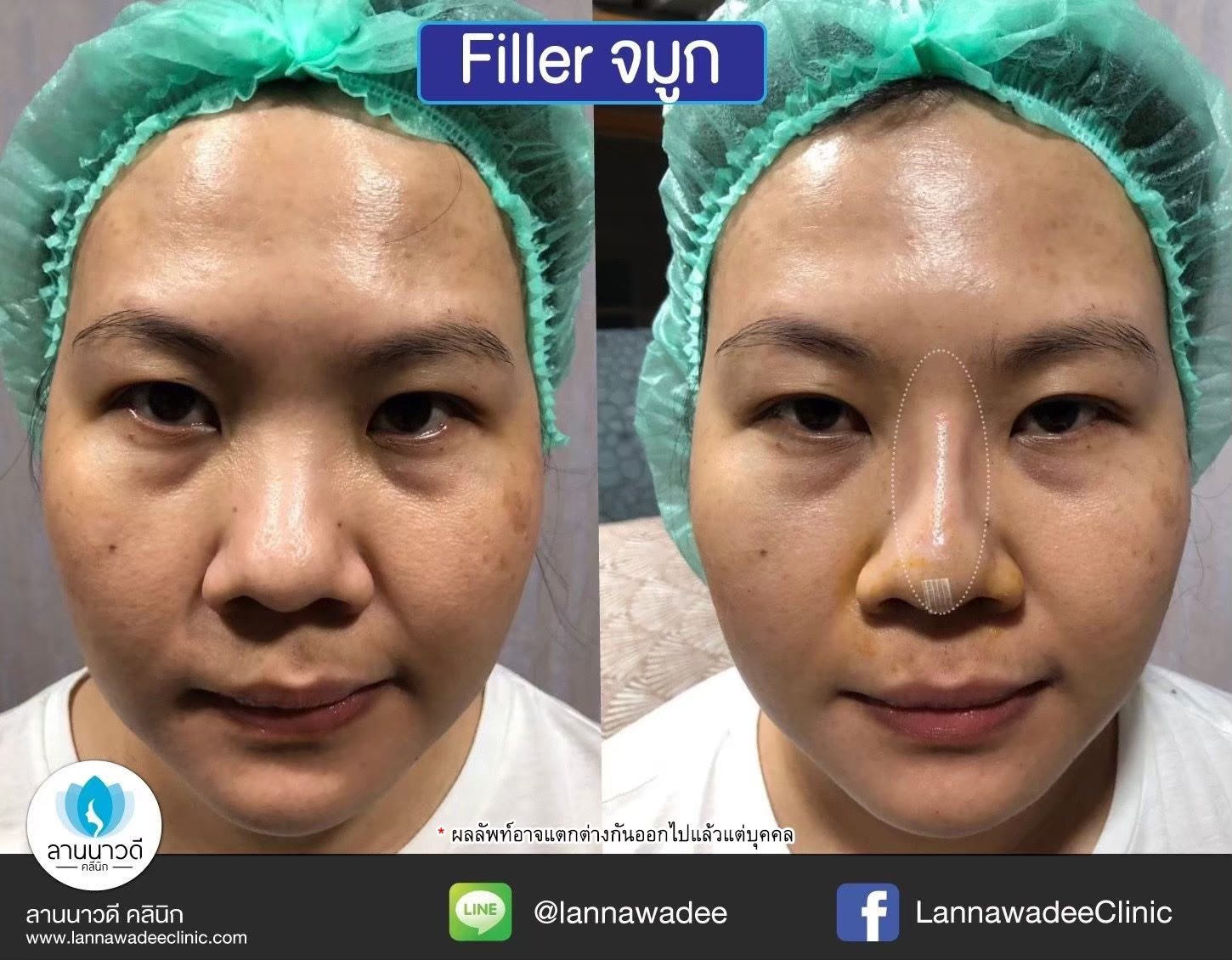 รีวิว
