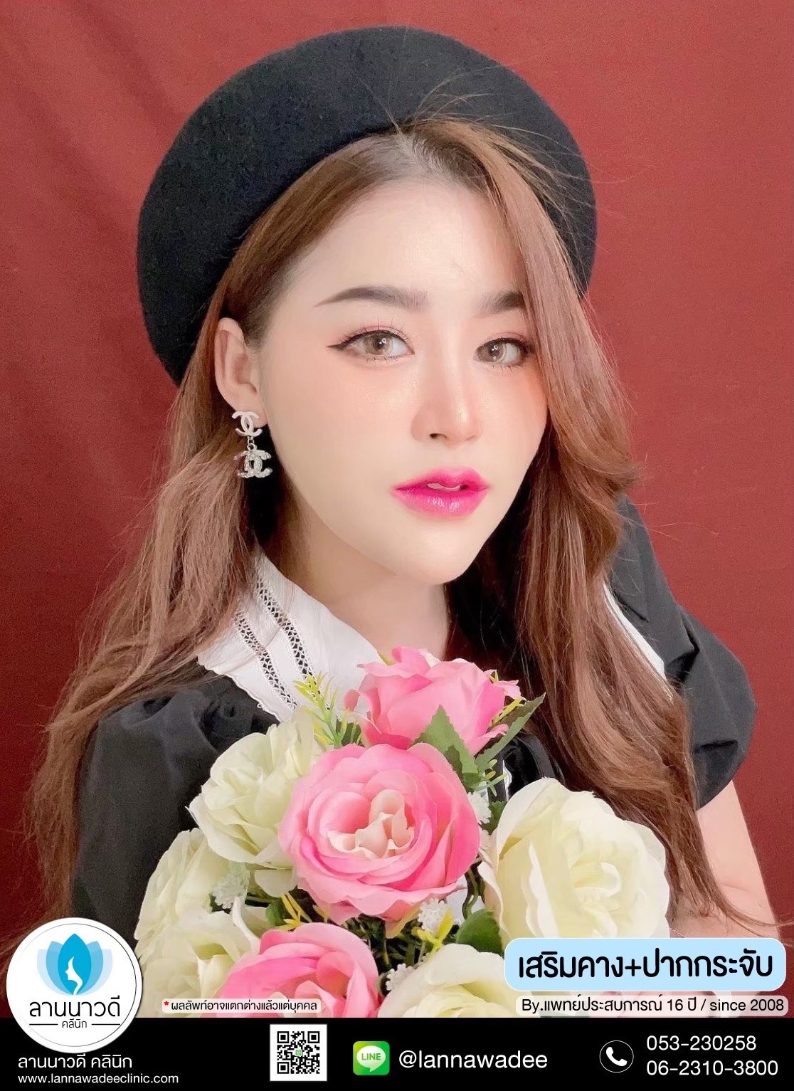 ปากกระจับ
